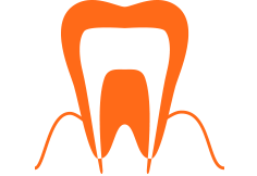 丁寧な処置で歯を抜かずに守る根管治療