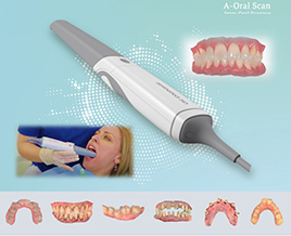口腔内スキャナー